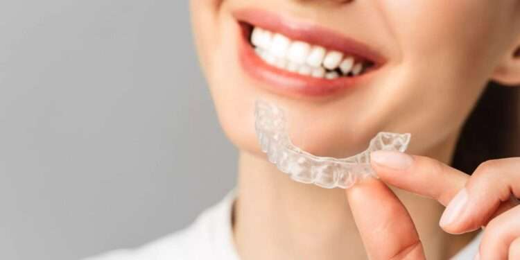 What Should You Expect When Getting Invisalign Clear Aligners?