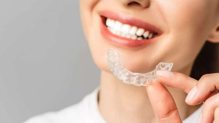 What Should You Expect When Getting Invisalign Clear Aligners?